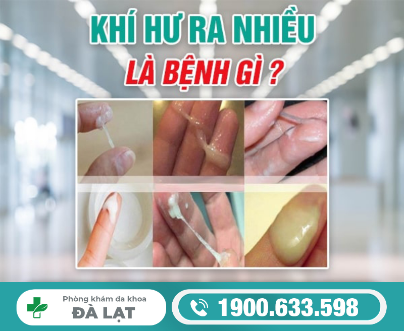 Hình ảnh minh họa